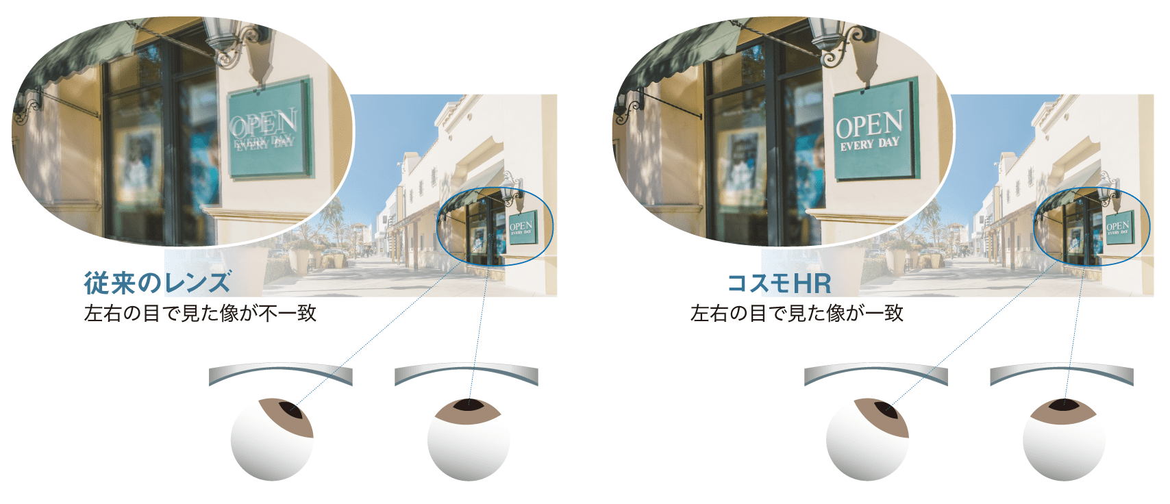両眼収差補正でレンズ側方も快適に